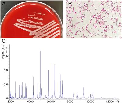 Bacteremia caused by Comamonas kerstersii in a patient with acute perforated appendicitis and localized peritonitis: case report and literature review